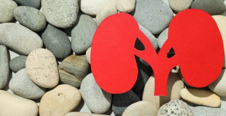 Kidney Stone Removal in Singapore - Minimally Invasive